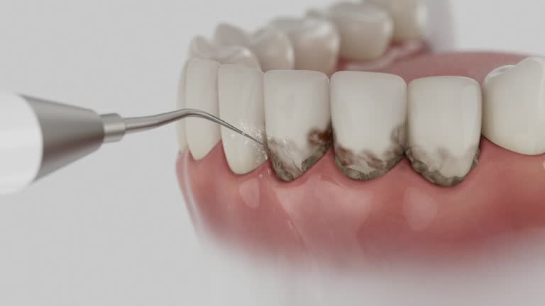 Reliable Dental contractor in Narberth, PA by Smile Center Dentistry